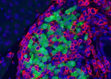 RNA 编辑破坏模拟早期疾病 不涉及病毒