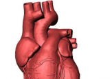 更新分配算法可以帮助捐赠心脏到达最需要它们的移植患者