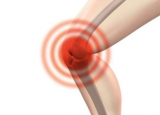 研究人员发现膝关节重建手术后需要采取更多行动来预防关节炎
